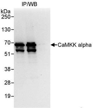 Rabbit CaMKK alpha Antibody