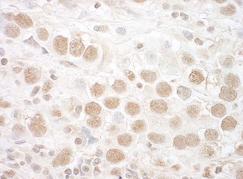 Rabbit CTNNBL1 Antibody