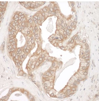 Rabbit Cortactin Antibody