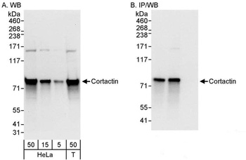 Rabbit Cortactin Antibody