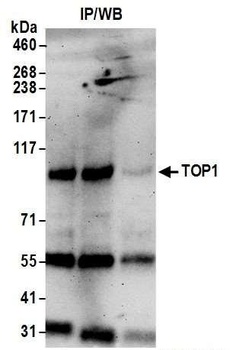 Rabbit TOP1 Antibody