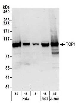 Rabbit TOP1 Antibody