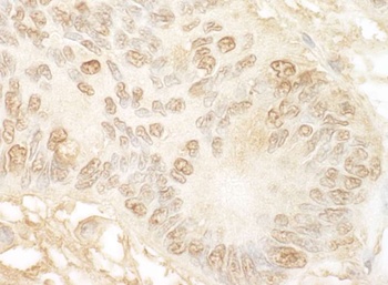 Rabbit JMY Antibody