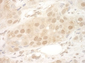 Rabbit eIF2B5 Antibody
