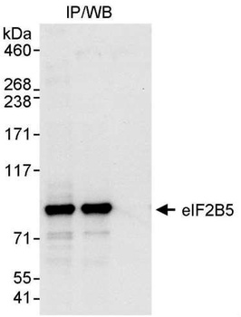 Rabbit eIF2B5 Antibody