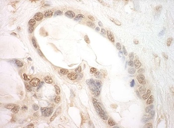 Rabbit eIF2B5 Antibody