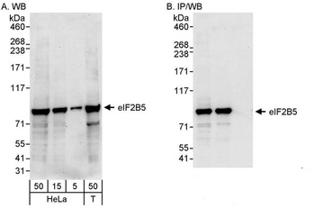 Rabbit eIF2B5 Antibody