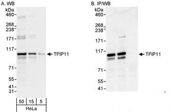 Rabbit TFIP11 Antibody