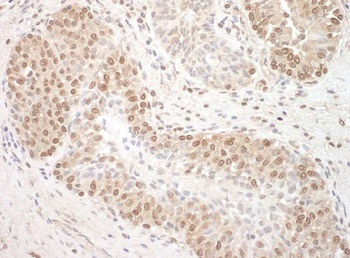 Rabbit TFIP11 Antibody
