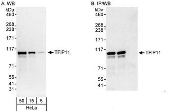 Rabbit TFIP11 Antibody