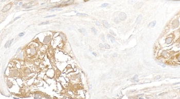 Rabbit Vinculin Antibody