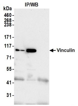 Rabbit Vinculin Antibody