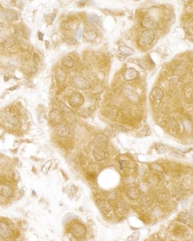 Rabbit MERIT40 Antibody