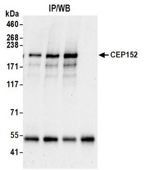 Rabbit CEP152 Antibody