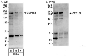 Rabbit CEP152 Antibody