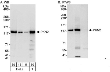 Rabbit PKN2 Antibody