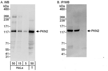 Rabbit PKN2 Antibody