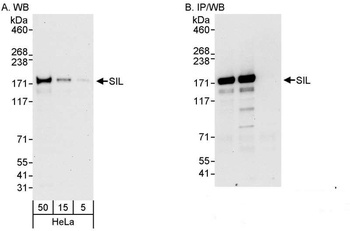 Rabbit SIL Antibody