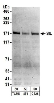 Rabbit SIL Antibody