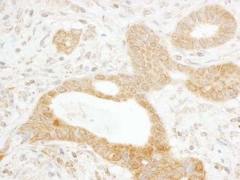 Rabbit Tankyrase 1 Antibody