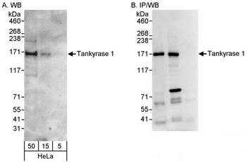 Rabbit Tankyrase 1 Antibody