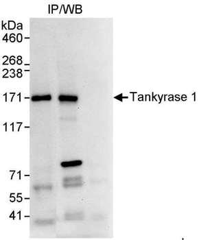 Rabbit Tankyrase 1 Antibody