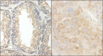 Rabbit BAD Antibody