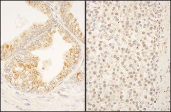 Rabbit FBXO38 Antibody