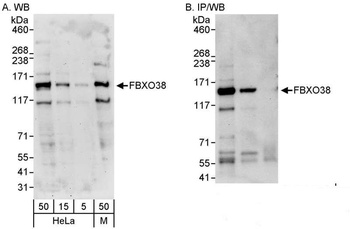 Rabbit FBXO38 Antibody