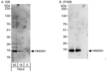 Rabbit HMGN1 Antibody