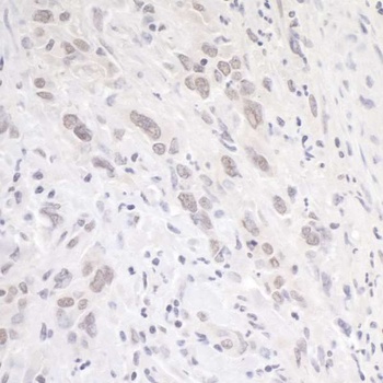 Rabbit p66alpha Antibody