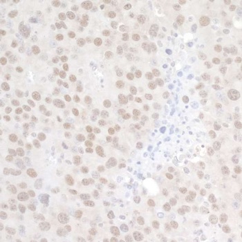 Rabbit p66alpha Antibody