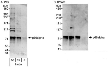 Rabbit p66alpha Antibody