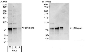 Rabbit p66alpha Antibody