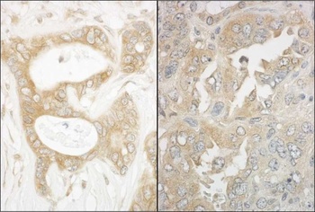 Rabbit EB1 Antibody