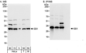 Rabbit EB1 Antibody