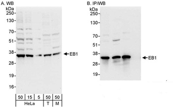 Rabbit EB1 Antibody
