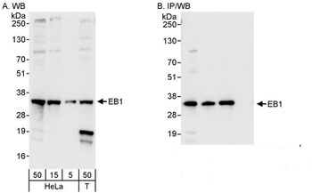Rabbit EB1 Antibody