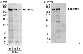 Rabbit CEP192 Antibody