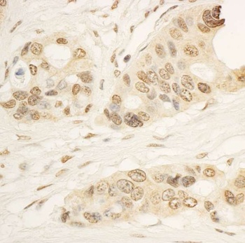 Rabbit RAI1 Antibody