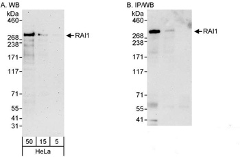 Rabbit RAI1 Antibody