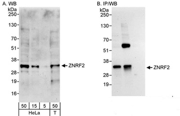 Rabbit ZNRF2 Antibody