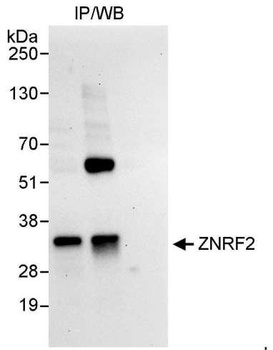 Rabbit ZNRF2 Antibody