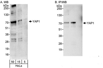 Rabbit YAP1 Antibody