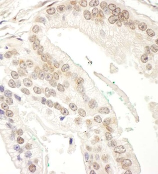 Rabbit RBM34 Antibody