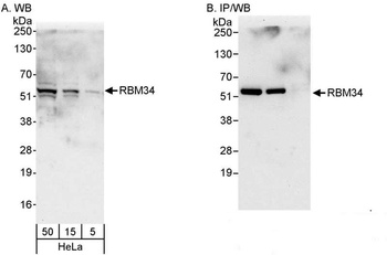 Rabbit RBM34 Antibody