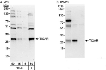 Rabbit TIGAR Antibody