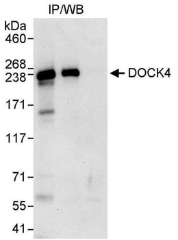 Rabbit DOCK4 Antibody