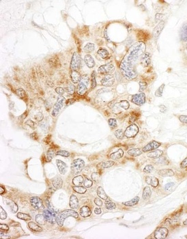 Rabbit DOCK4 Antibody