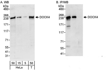 Rabbit DOCK4 Antibody